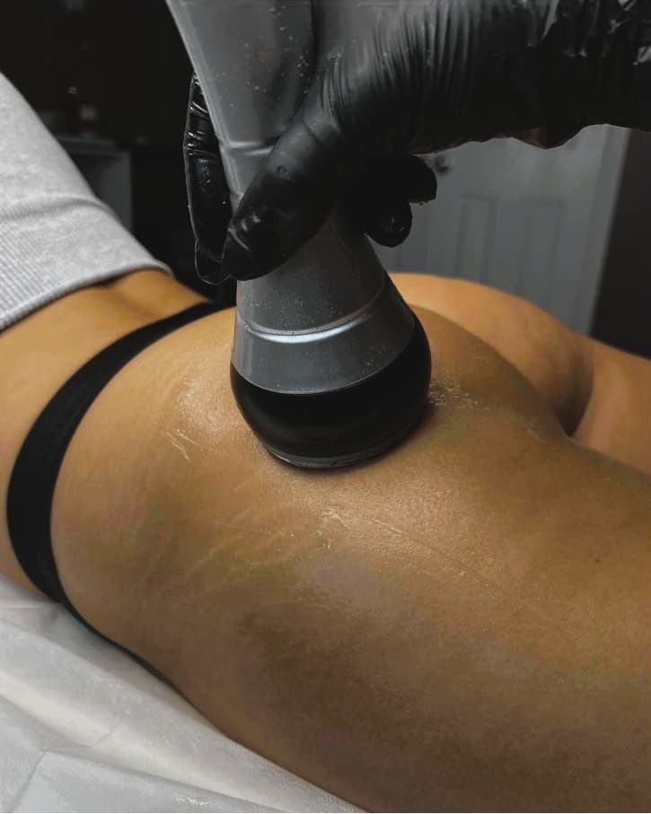 Liposonix™ - Eliminador de Grasa