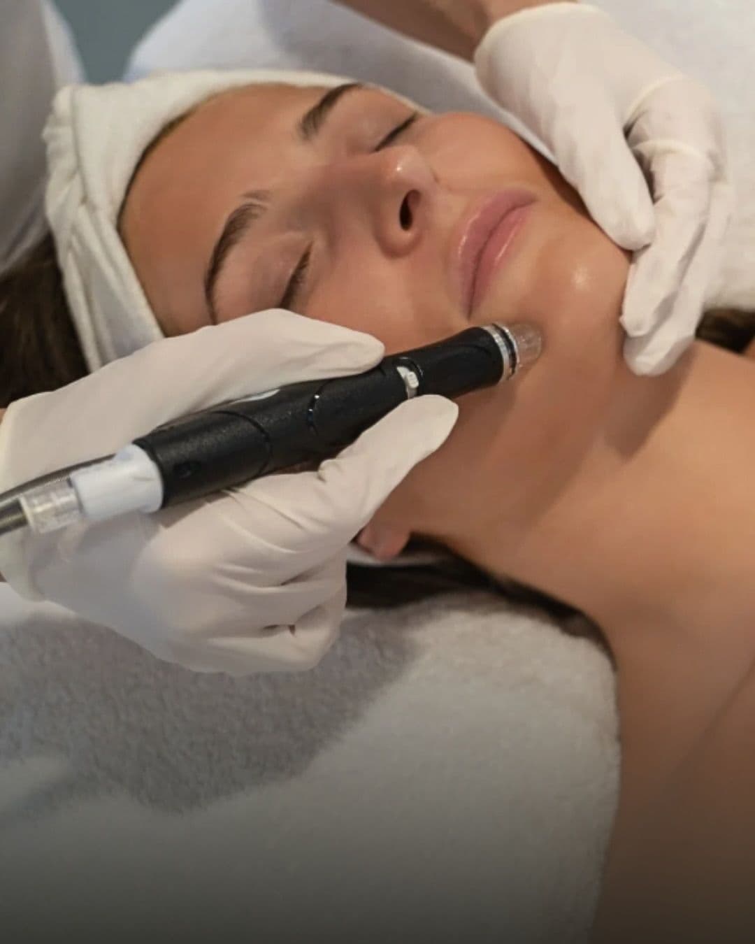 Dermapen - Microneedling