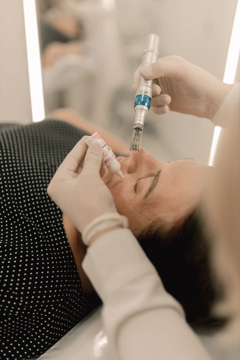 Exosomas + Microneedling - Regeneración celular